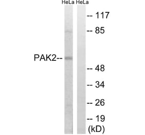 Western Blot - Anti-PAK2 Antibody (B8161) - Antibodies.com