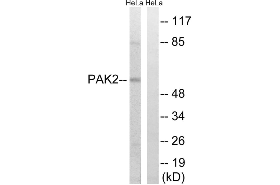 Western Blot - Anti-PAK2 Antibody (B8161) - Antibodies.com