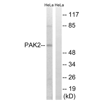 Western Blot - Anti-PAK2 Antibody (B8161) - Antibodies.com