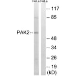 Western Blot - Anti-PAK2 Antibody (B8161) - Antibodies.com