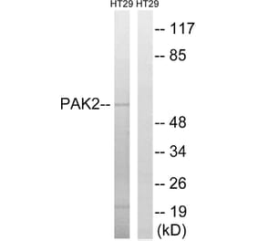 Western Blot - Anti-PAK2 Antibody (B8162) - Antibodies.com