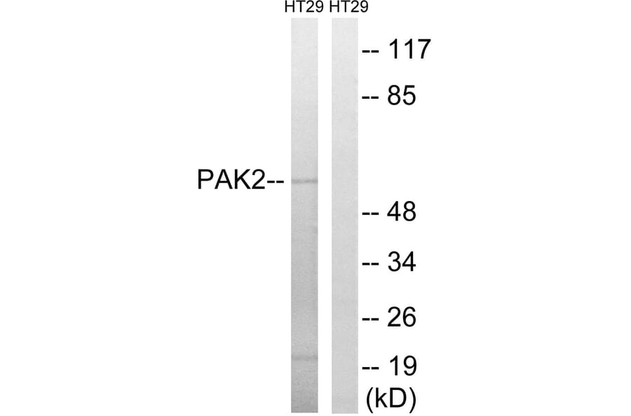 Western Blot - Anti-PAK2 Antibody (B8162) - Antibodies.com