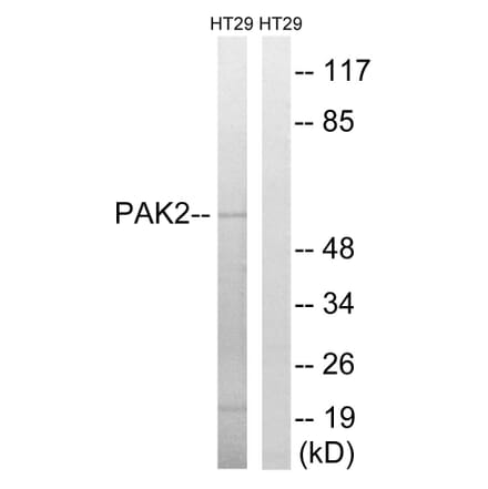 Western Blot - Anti-PAK2 Antibody (B8162) - Antibodies.com