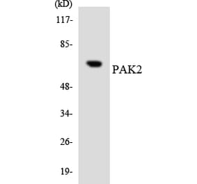 Western Blot - Anti-PAK2 Antibody (R12-3297) - Antibodies.com