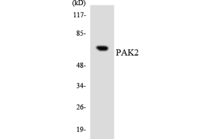 Western Blot - Anti-PAK2 Antibody (R12-3297) - Antibodies.com