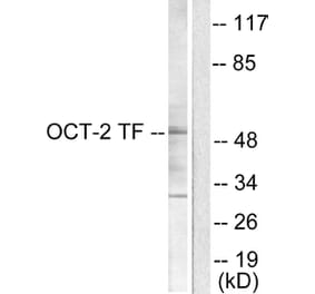 Western Blot - Anti-OCT2 Antibody (C0282) - Antibodies.com