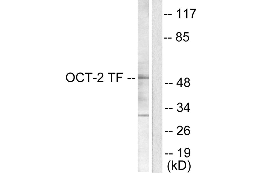 Western Blot - Anti-OCT2 Antibody (C0282) - Antibodies.com
