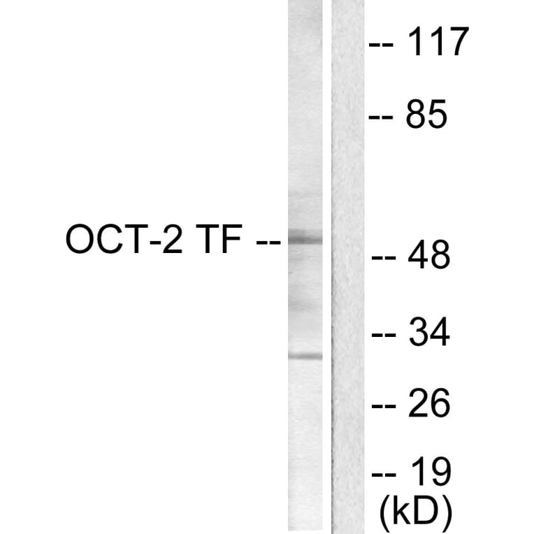 Western Blot - Anti-OCT2 Antibody (C0282) - Antibodies.com