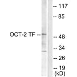 Western Blot - Anti-OCT2 Antibody (C0282) - Antibodies.com