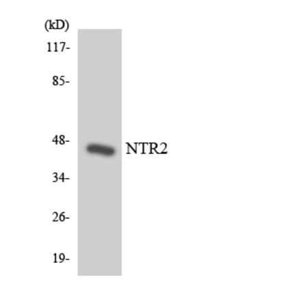 Western Blot - Anti-NTR2 Antibody (R12-3112) - Antibodies.com