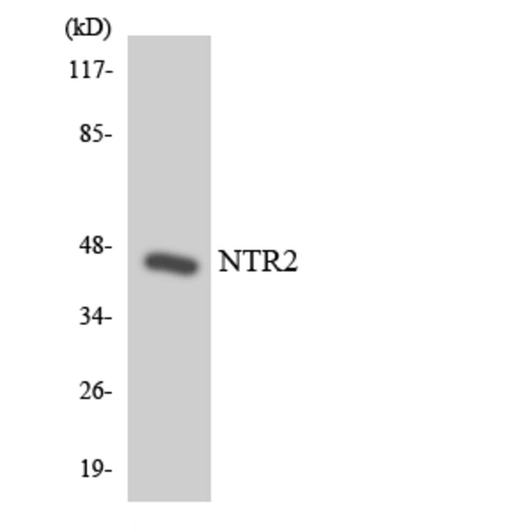 Western Blot - Anti-NTR2 Antibody (R12-3112) - Antibodies.com