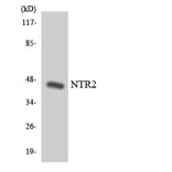 Western Blot - Anti-NTR2 Antibody (R12-3112) - Antibodies.com