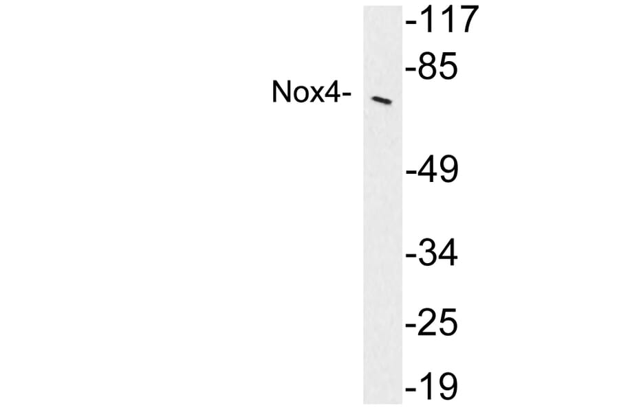 Western Blot - Anti-Nox4 Antibody (R12-2272) - Antibodies.com