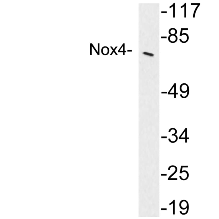 Western Blot - Anti-Nox4 Antibody (R12-2272) - Antibodies.com