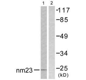 Western Blot - Anti-NM23 Antibody (C0278) - Antibodies.com