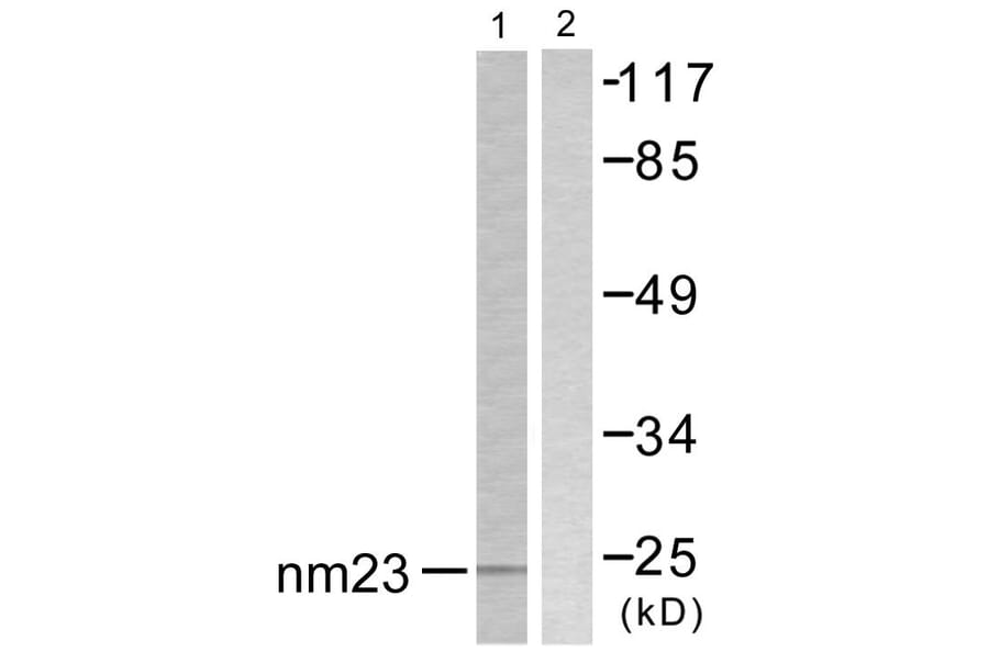 Western Blot - Anti-NM23 Antibody (C0278) - Antibodies.com