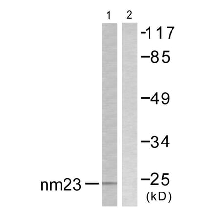 Western Blot - Anti-NM23 Antibody (C0278) - Antibodies.com