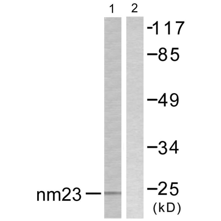 Western Blot - Anti-NM23 Antibody (C0278) - Antibodies.com
