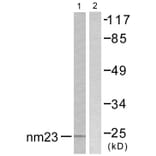 Western Blot - Anti-NM23 Antibody (C0278) - Antibodies.com