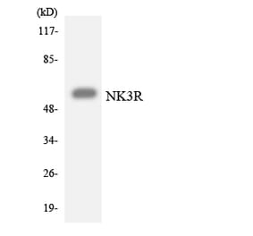 Western Blot - Anti-NK3R Antibody (R12-3093) - Antibodies.com