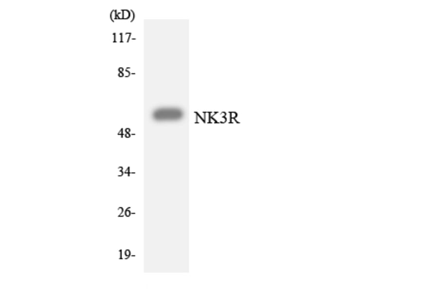 Western Blot - Anti-NK3R Antibody (R12-3093) - Antibodies.com