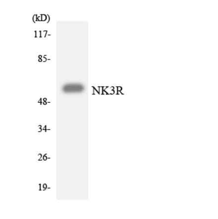 Western Blot - Anti-NK3R Antibody (R12-3093) - Antibodies.com