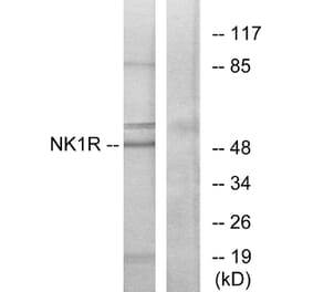 Western Blot - Anti-NK1R Antibody (G402) - Antibodies.com