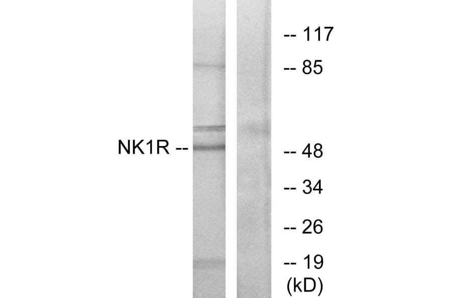 Western Blot - Anti-NK1R Antibody (G402) - Antibodies.com