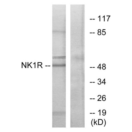 Western Blot - Anti-NK1R Antibody (G402) - Antibodies.com