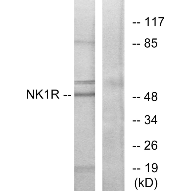 Western Blot - Anti-NK1R Antibody (G402) - Antibodies.com