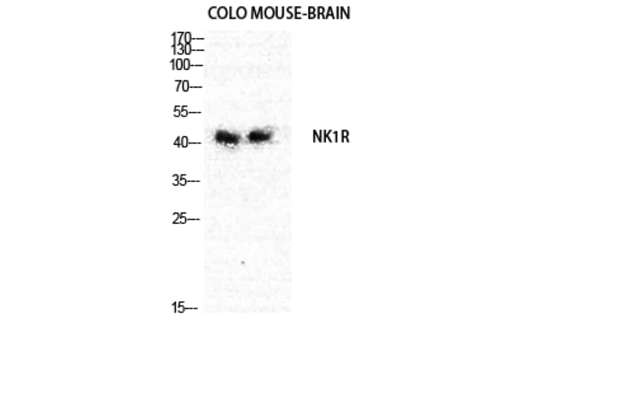 Western Blot - Anti-NK1R Antibody (G402) - Antibodies.com