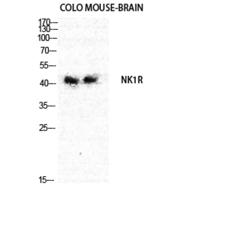 Western Blot - Anti-NK1R Antibody (G402) - Antibodies.com
