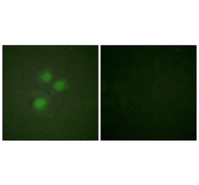 Immunofluorescence - Anti-NIFK Antibody (B1106) - Antibodies.com