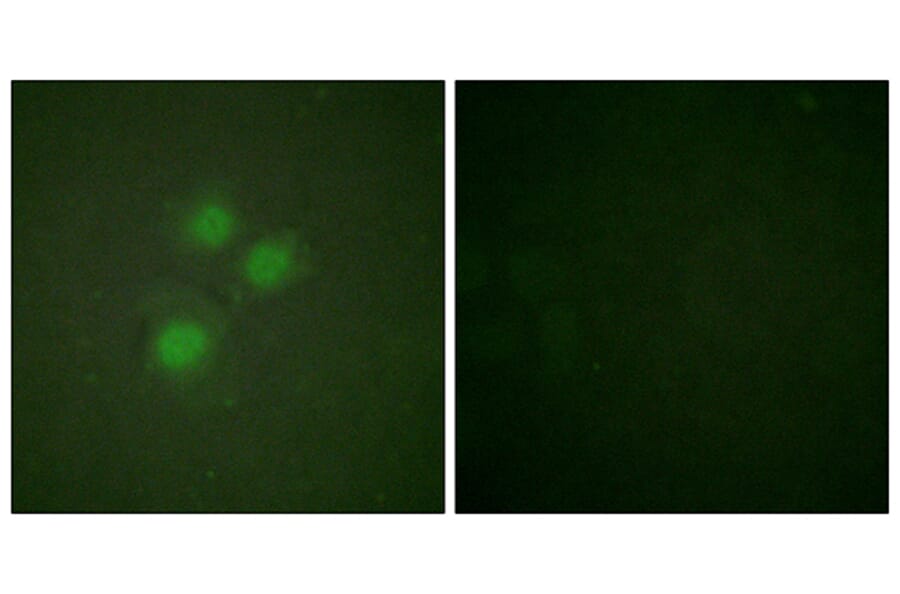 Immunofluorescence - Anti-NIFK Antibody (B1106) - Antibodies.com