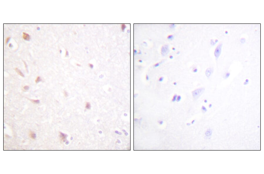 Immunohistochemistry - Anti-NIFK Antibody (B1106) - Antibodies.com