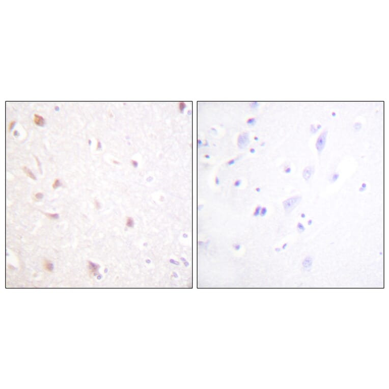 Immunohistochemistry - Anti-NIFK Antibody (B1106) - Antibodies.com