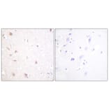 Immunohistochemistry - Anti-NIFK Antibody (B1106) - Antibodies.com