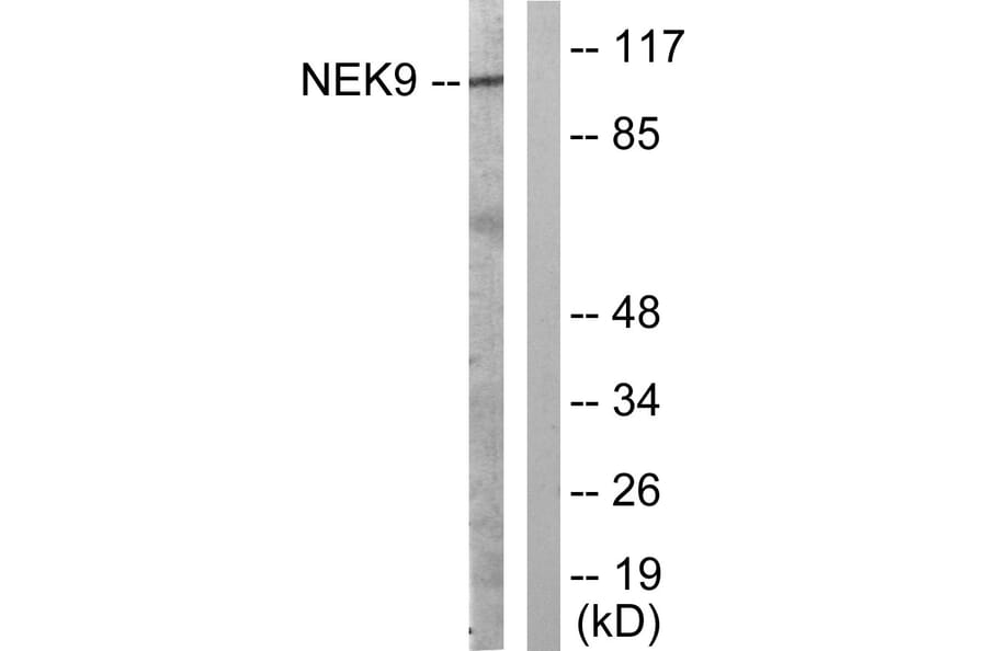 Western Blot - Anti-NEK9 Antibody (B1159) - Antibodies.com