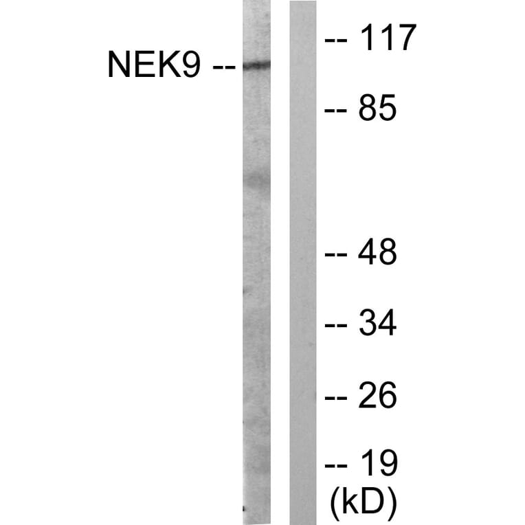 Western Blot - Anti-NEK9 Antibody (B1159) - Antibodies.com