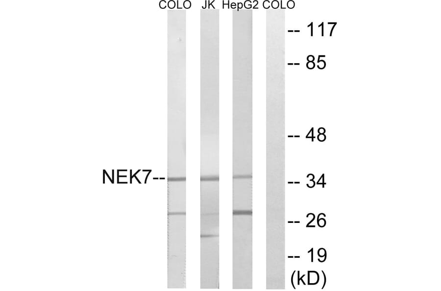 Western Blot - Anti-NEK7 Antibody (C18583) - Antibodies.com