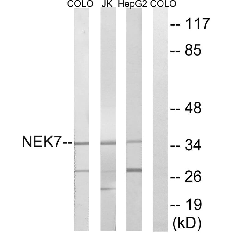 Western Blot - Anti-NEK7 Antibody (C18583) - Antibodies.com