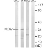 Western Blot - Anti-NEK7 Antibody (C18583) - Antibodies.com