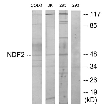 Western Blot - Anti-NDF2 Antibody (C11108) - Antibodies.com