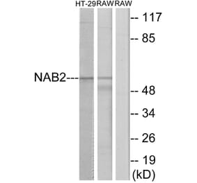 Western Blot - Anti-NAB2 Antibody (C11102) - Antibodies.com