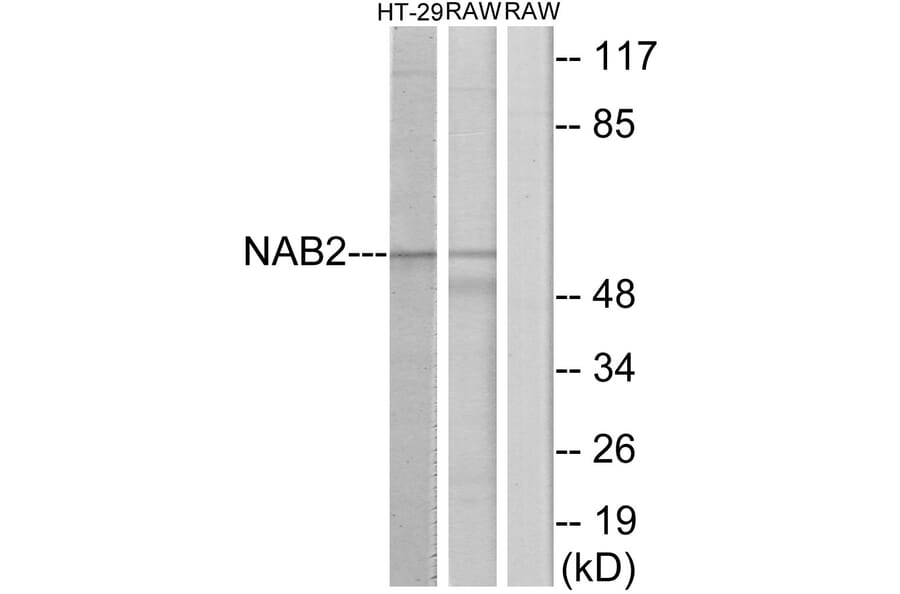 Western Blot - Anti-NAB2 Antibody (C11102) - Antibodies.com