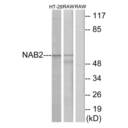 Western Blot - Anti-NAB2 Antibody (C11102) - Antibodies.com