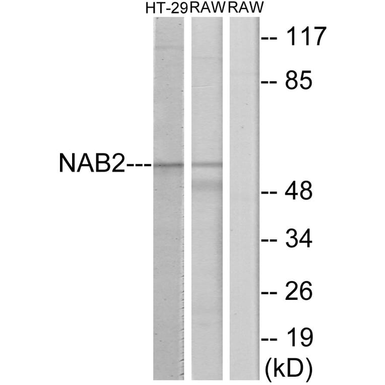 Western Blot - Anti-NAB2 Antibody (C11102) - Antibodies.com
