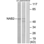 Western Blot - Anti-NAB2 Antibody (C11102) - Antibodies.com