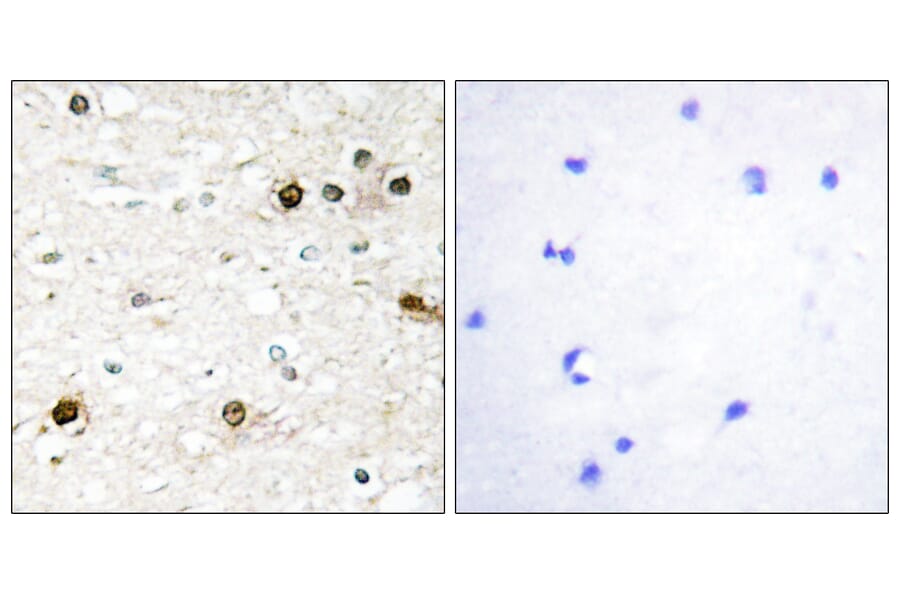 Immunohistochemistry - Anti-NAB2 Antibody (C11102) - Antibodies.com