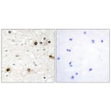 Immunohistochemistry - Anti-NAB2 Antibody (C11102) - Antibodies.com